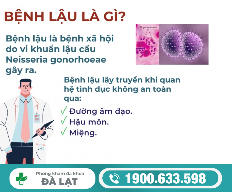 Hình ảnh minh họa